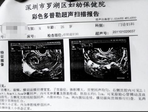 孕妇一个月可以做几次B超，科学建议与注意事项